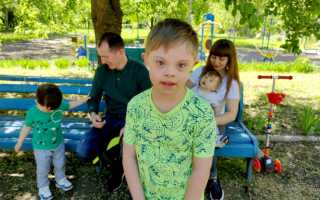 Родился ребенок с синдромом Дауна. Что делать?