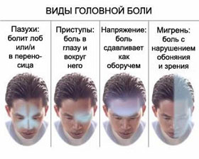 vidy_golovnaya_bol